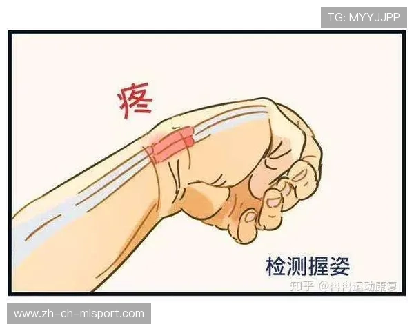 理疗师：手腕按出腱鞘炎的双手，手腕腱鞘炎按回去